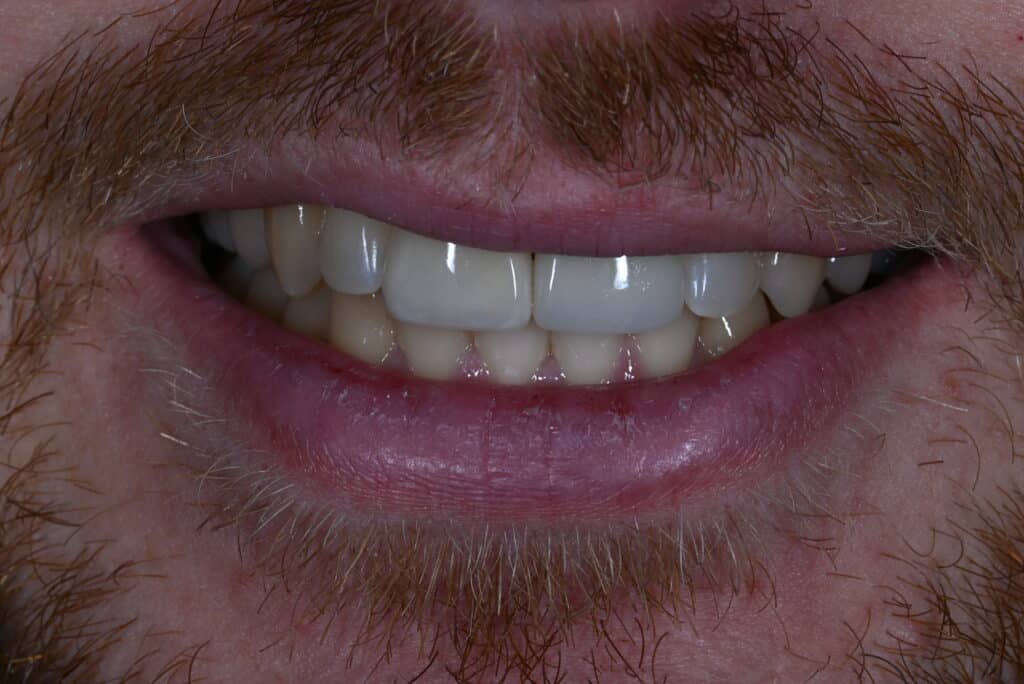 After